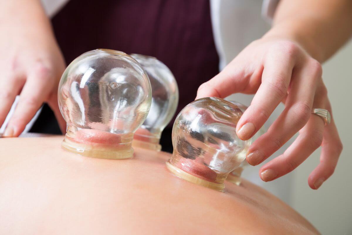 woman performing cupping therapy