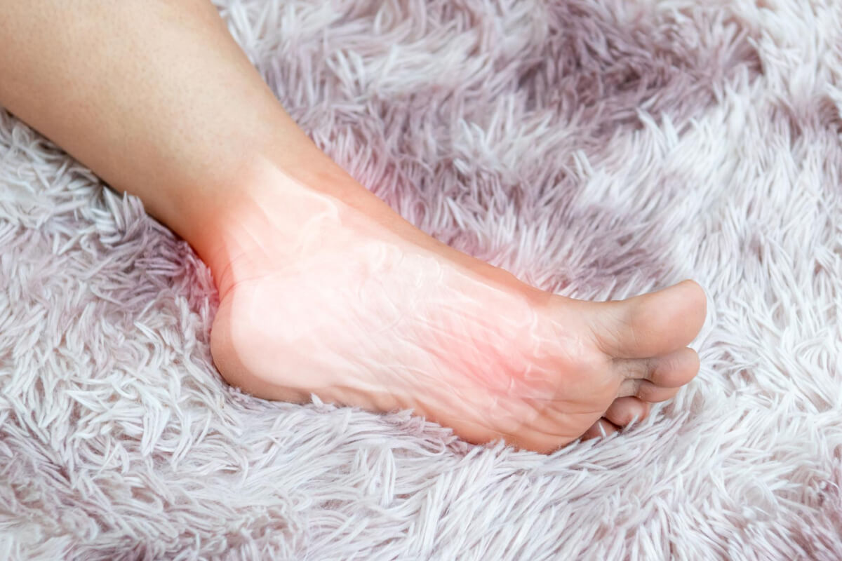 What is Gout and How to Relieve the Pain